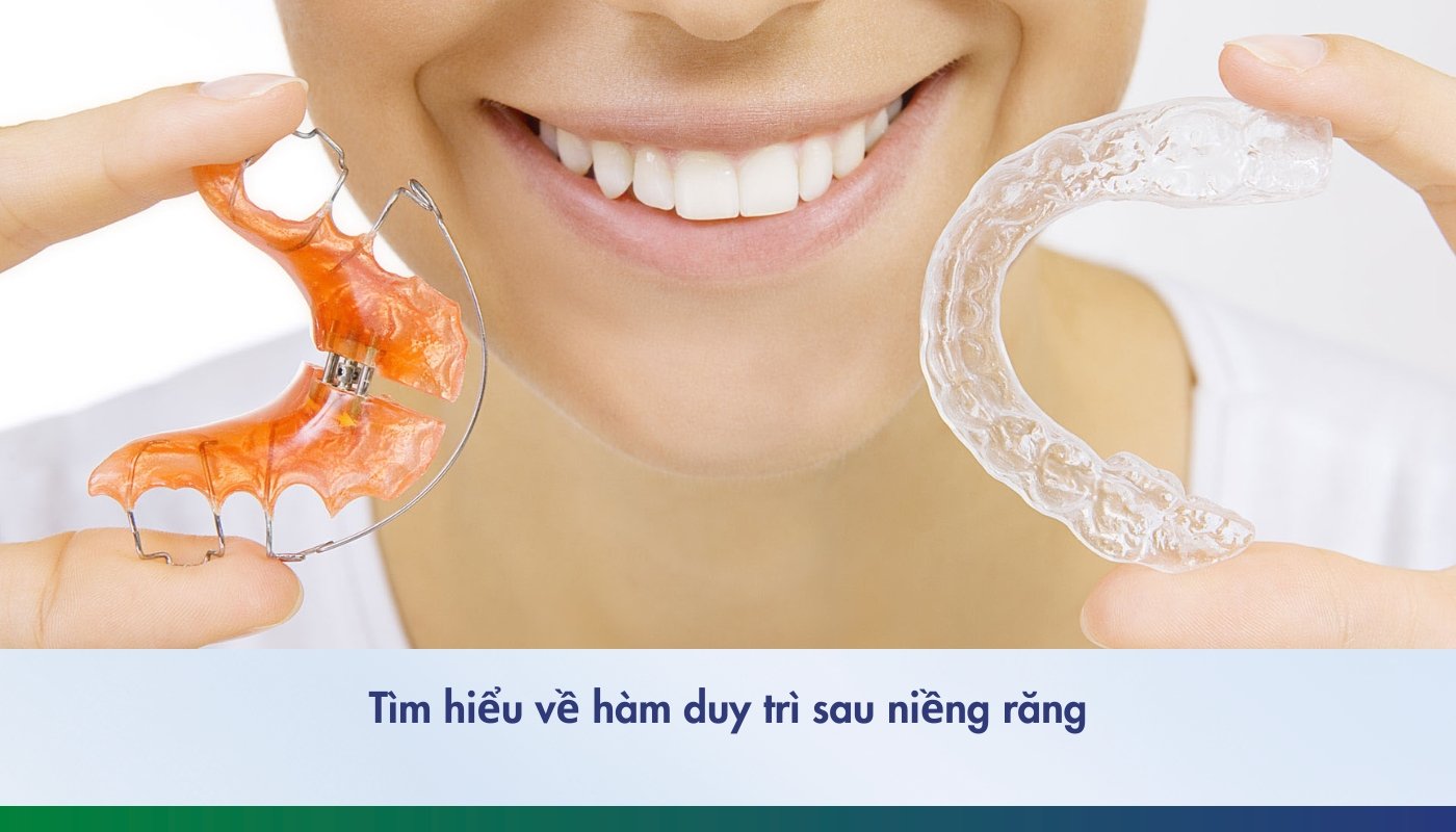 Tìm hiểu về hàm duy trì sau niềng răng