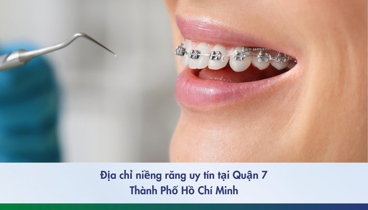 Top 5 địa chỉ niềng răng uy tín Quận 7