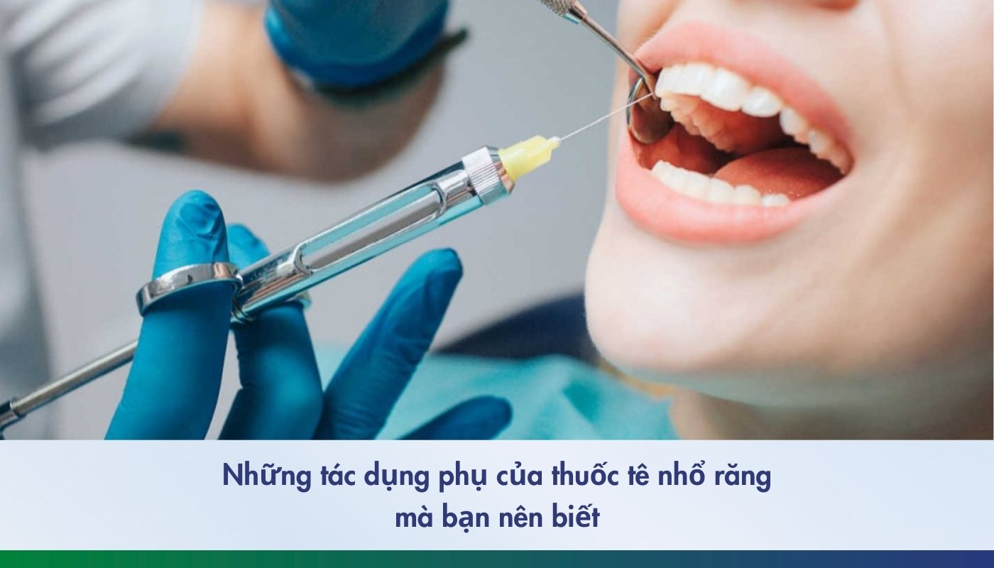 Những tác dụng phụ của thuốc tê nhổ răng mà bạn nên biết