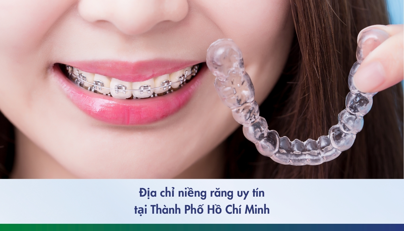 Top 5 địa chỉ niềng răng uy tín tại Thành Phố Hồ Chí Minh