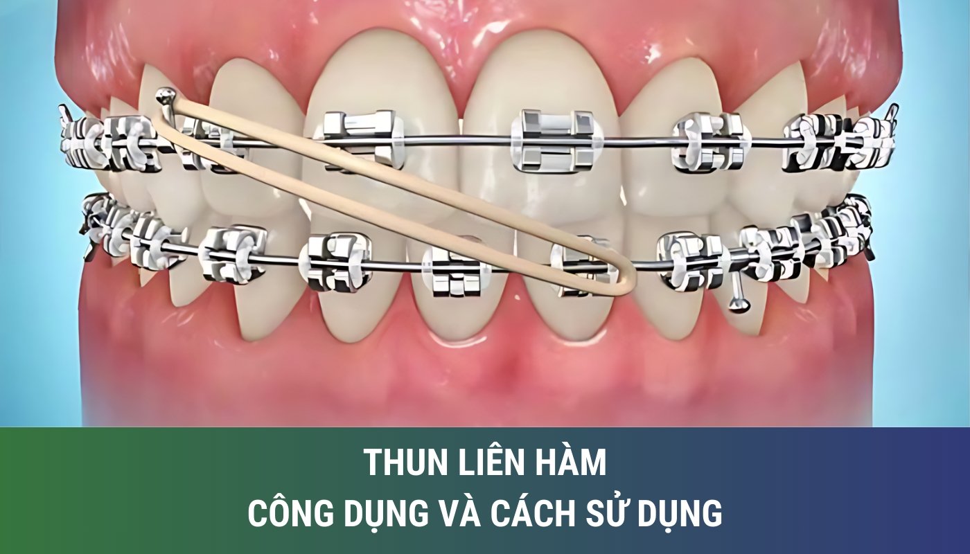 Thun liên hàm: công dụng và cách sử dụng