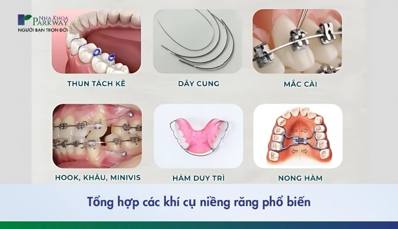 Các khí cụ niềng răng 