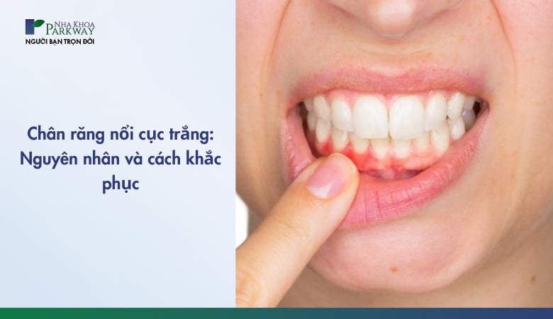 Chân răng nổi cục trắng