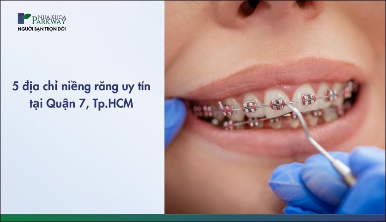 Địa chỉ niềng răng uy tín Quận 7 - 1