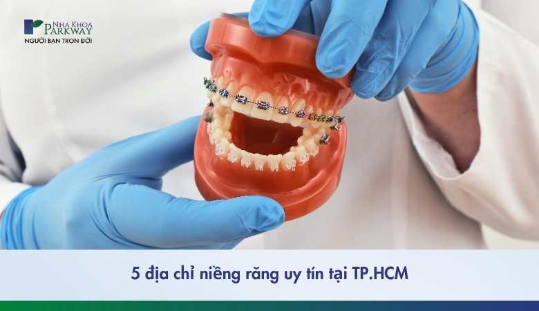 5 địa chỉ niềng răng uy tín tại Thành Phố Hồ Chí Minh