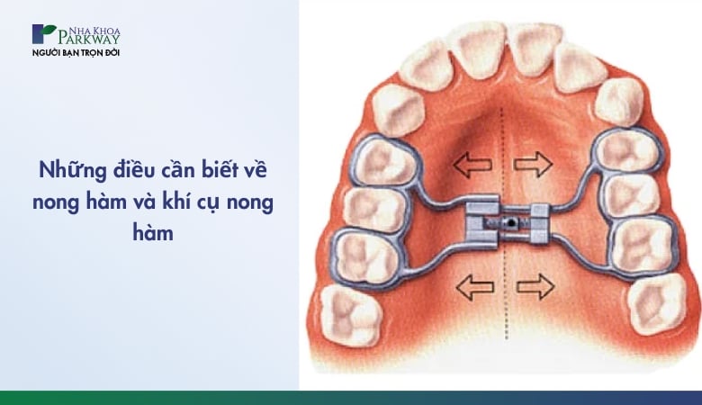 Khí cụ nong hàm - 1