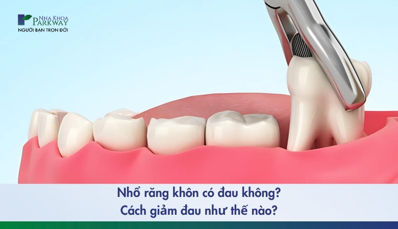 nhổ răng khôn có đau không