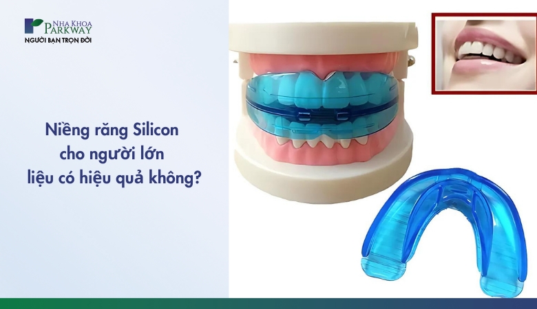 Niềng răng silicon cho người lớn