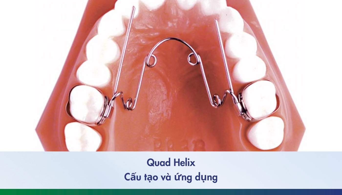 Hình ảnh quad helix