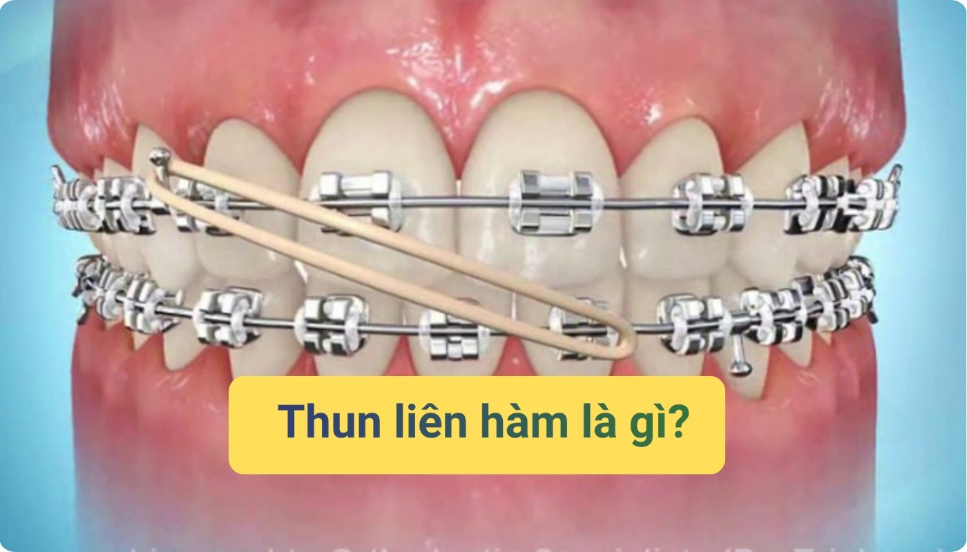 thun liên hàm là gì