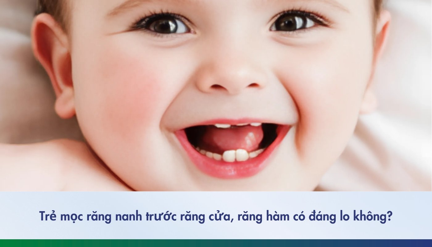 trẻ mọc răng nanh trước răng cửa