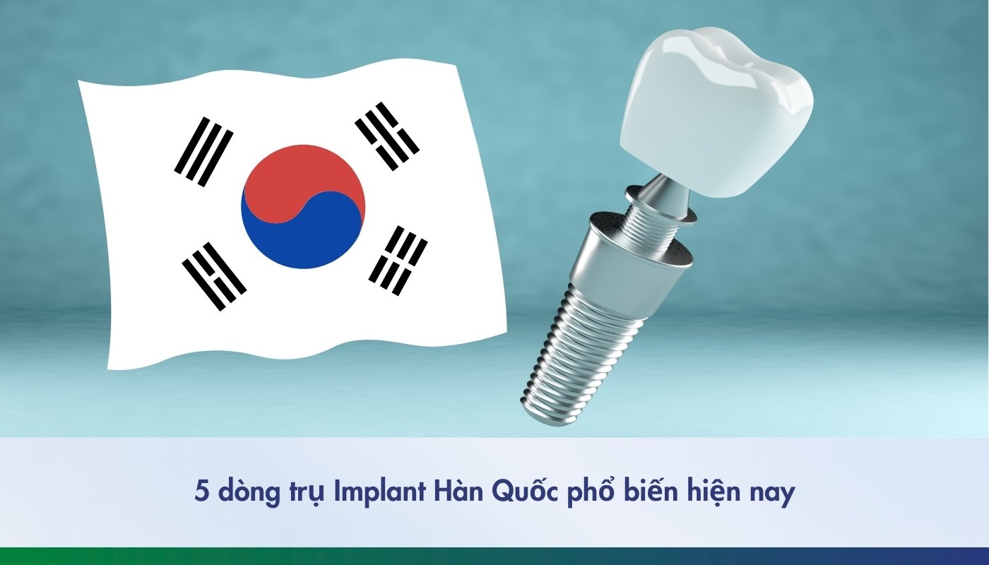 5 loại trụ Implant Hàn Quốc phổ biến