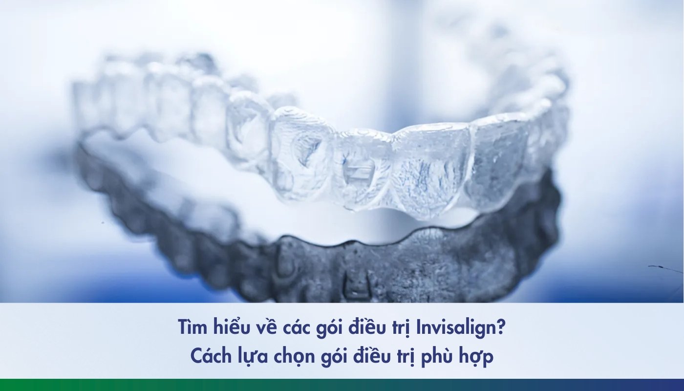 Tìm hiểu các gói điều trị Invisalign