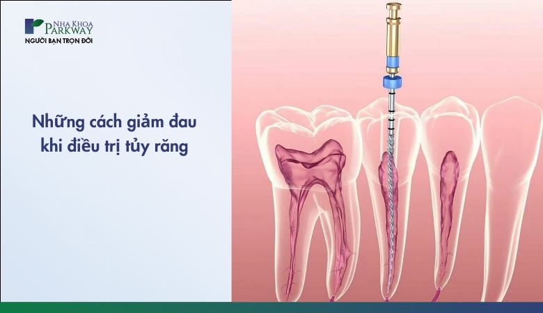 Chữa tủy răng có đau không - 1