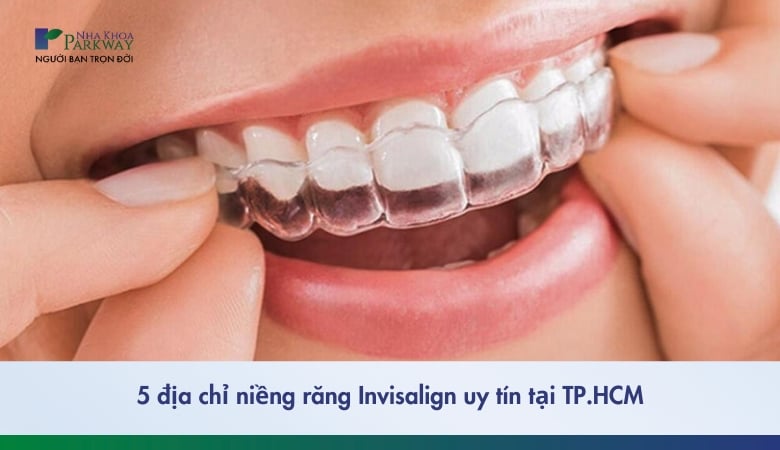 địa chỉ niềng răng invisalign uy tín - 1