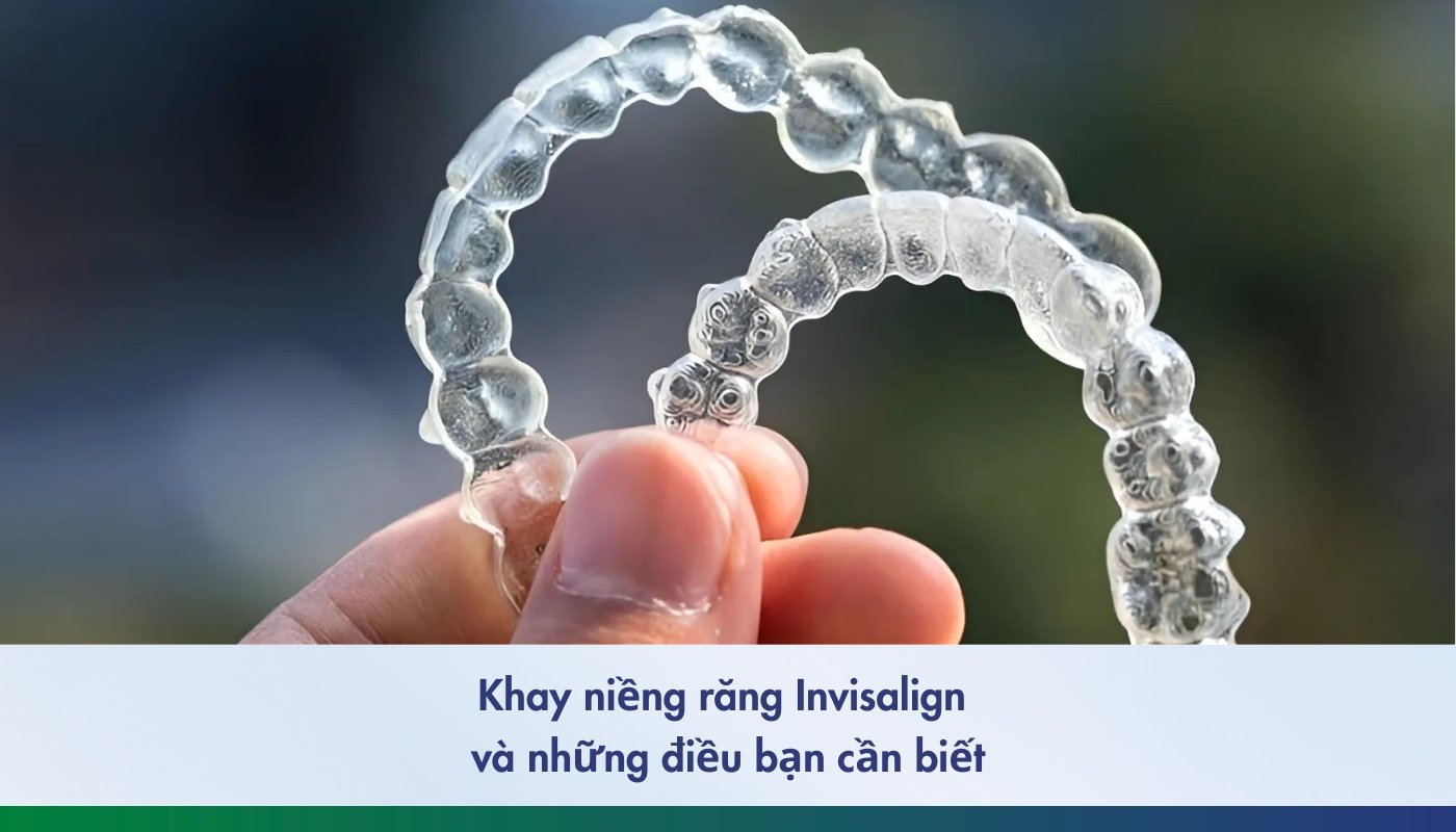 Khay niềng Invisalign và những điều bạn cần biết