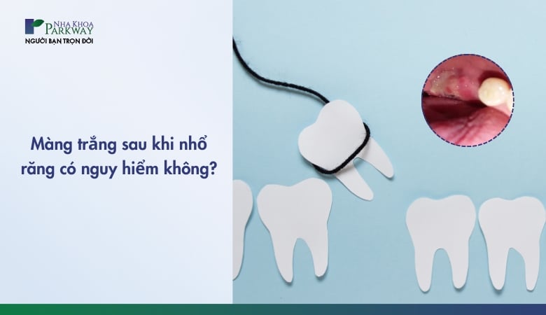 mảng trắng sau khi nhổ răng - 1