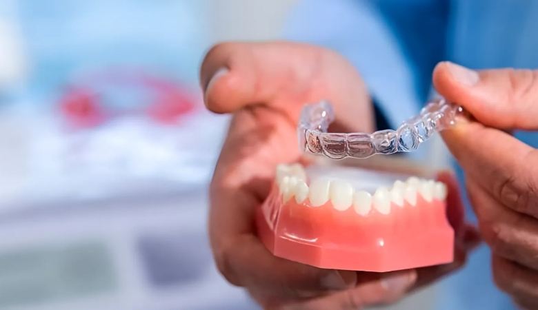 quy trình niềng răng invisalign - 2