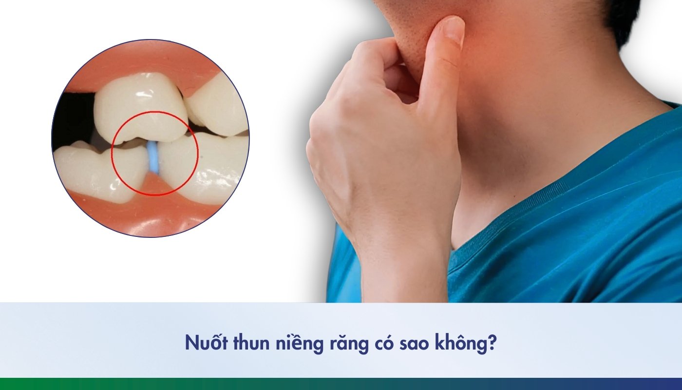 Nuốt thun niềng răng có sao không - 2