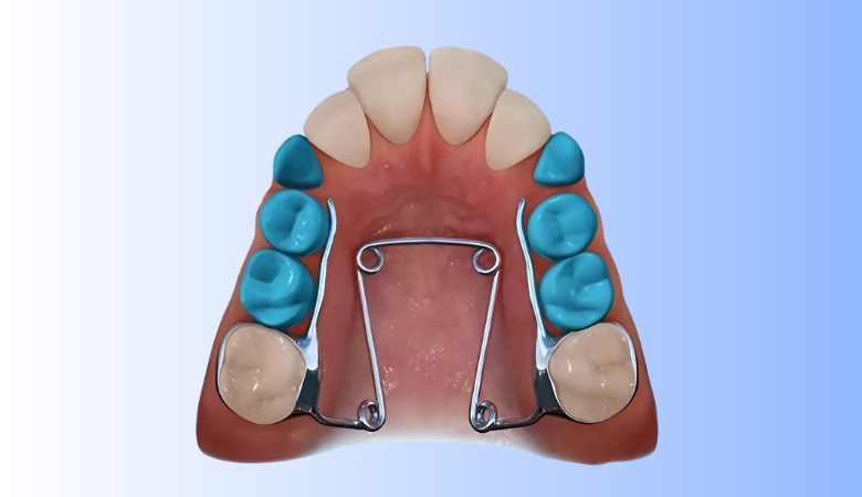 hình ảnh quad helix