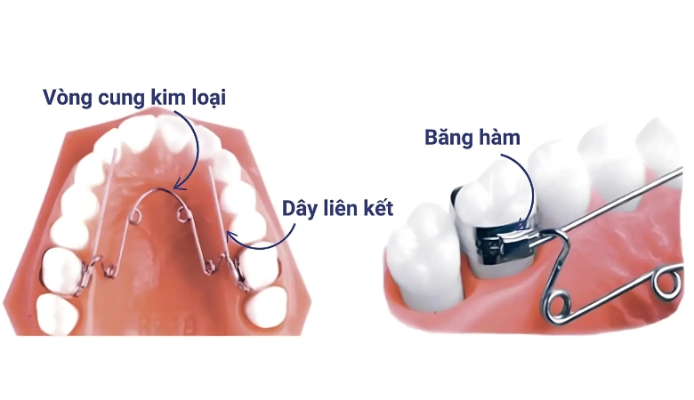 cấu tạo quad helix