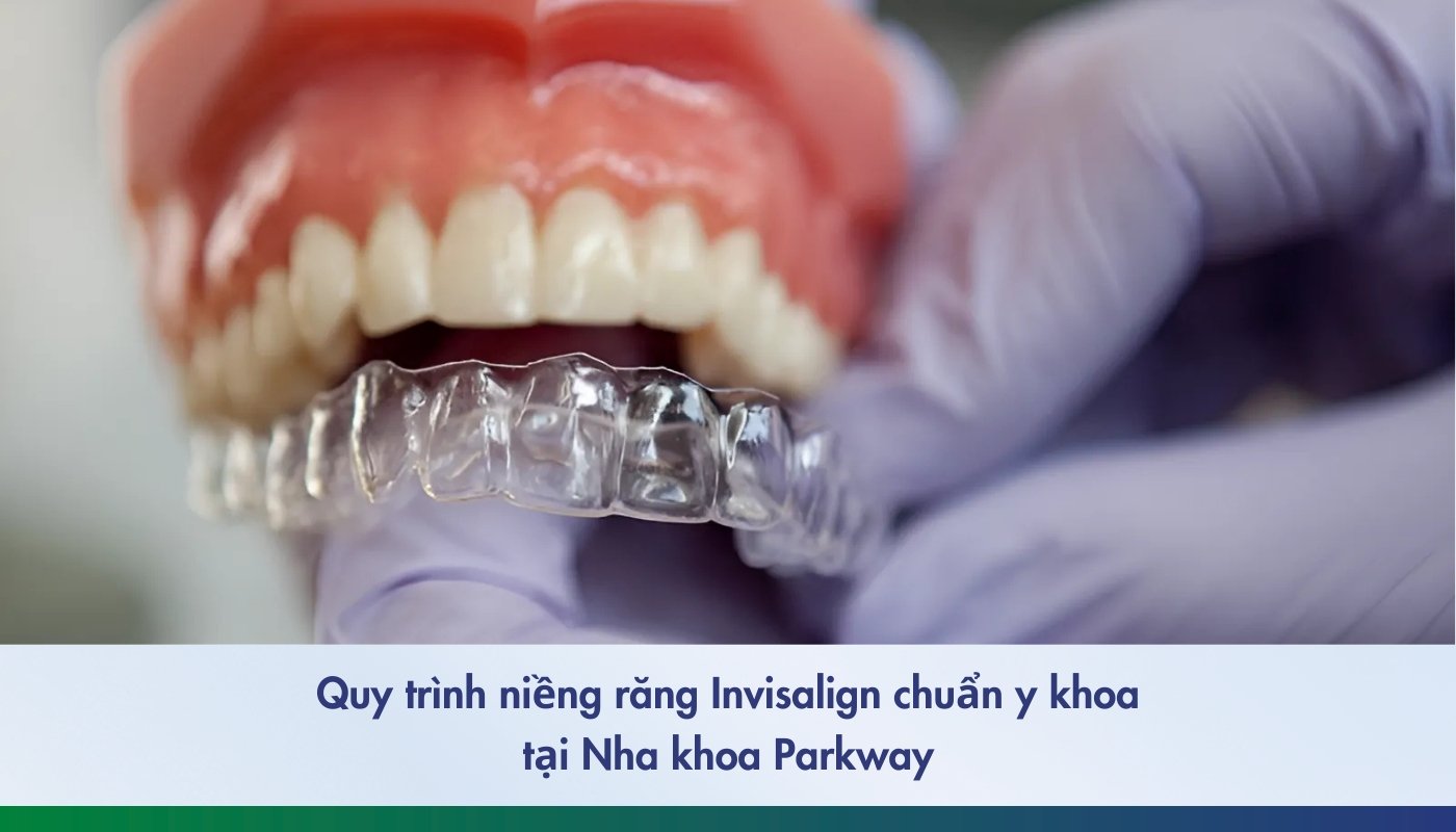 Quy trình niềng Invisalign chuẩn y khoa tại Parkway