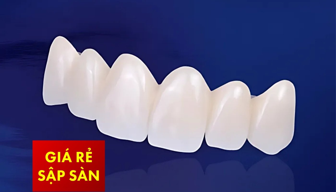 Gói Zen - Răng sứ Zirconia DMax