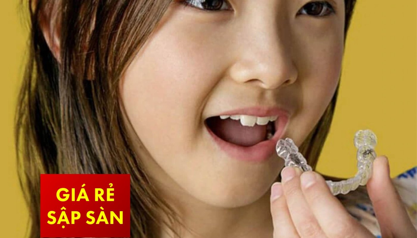 Gói Zen – Gói tiền chỉnh nha Invisalign First – Phase 2