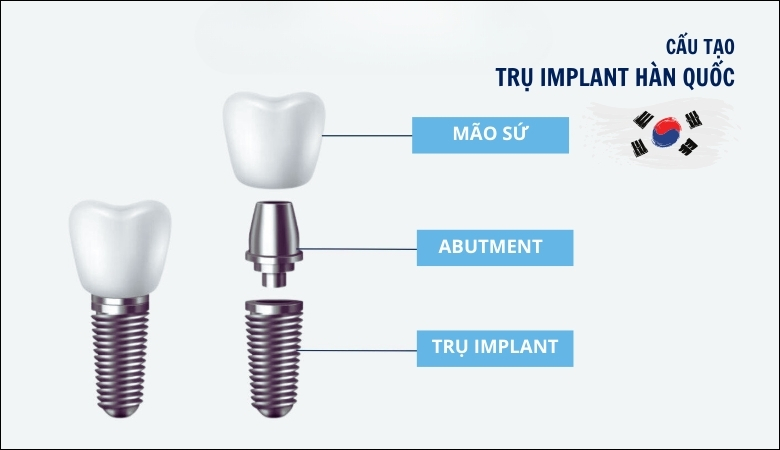 Trụ Implant Hàn Quốc - 3