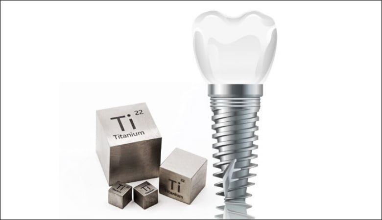 Trụ Implant Hàn Quốc - 4