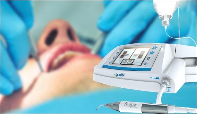 Máy Piezotome được ứng dụng rộng rãi trong các quy trình nhổ răng 