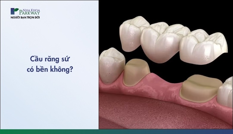 Làm cầu răng sứ có bền không