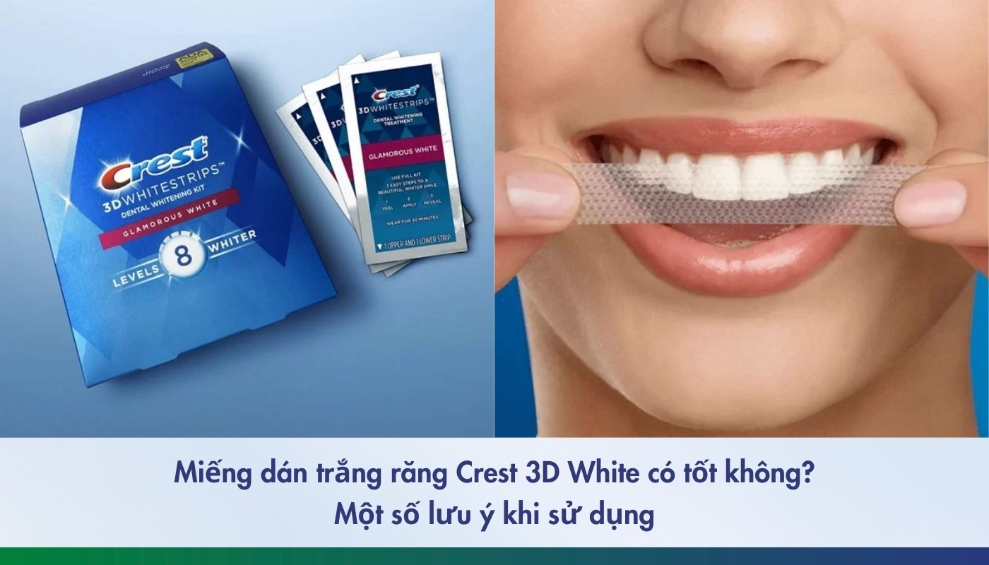 Đánh giá miếng dán trắng răng Crest 3D White