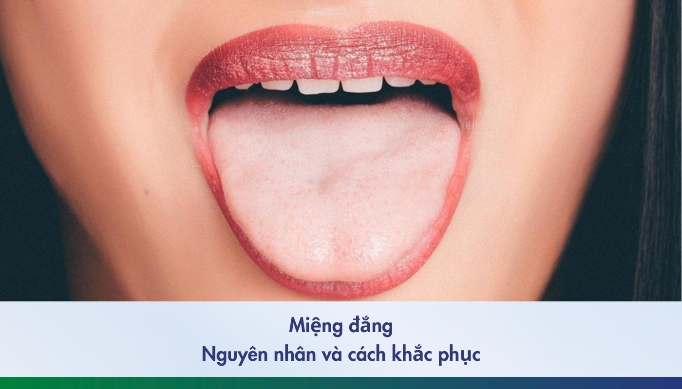Miệng đăng có phải bệnh không