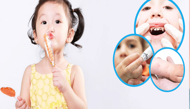 nguyên nhân sún răng