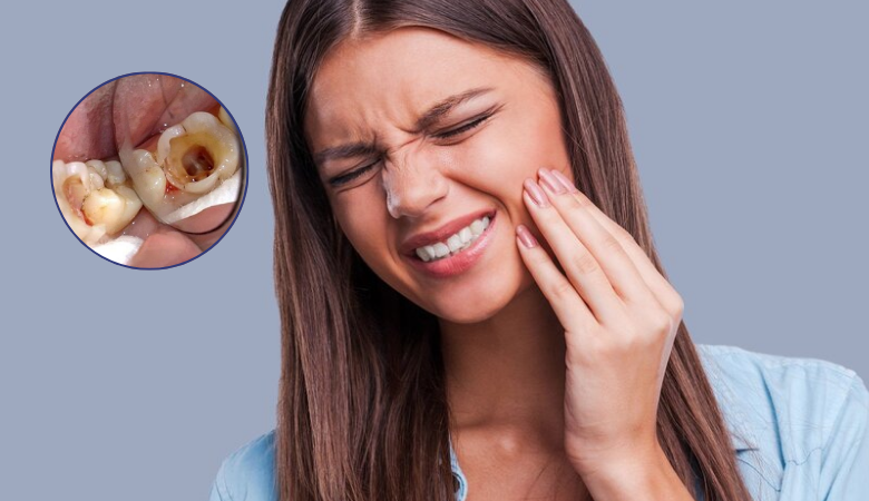 nhức răng do sâu răng