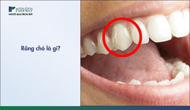 Răng chó là gì?