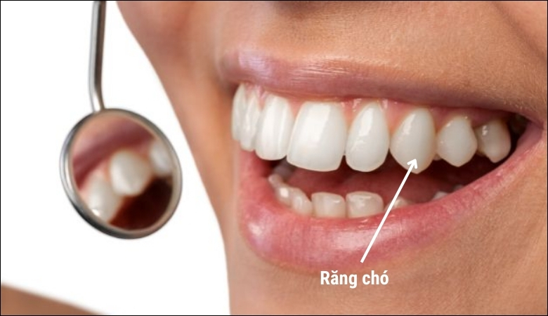 Răng chó có vai trò cắn và xé thức ăn