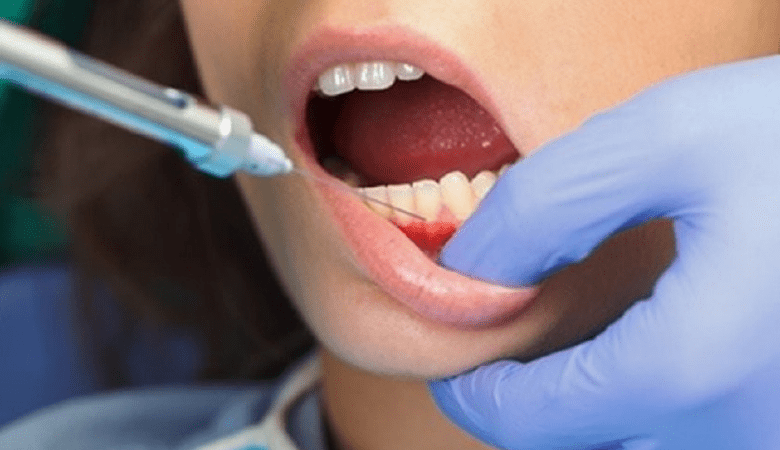 Tiêm botox để khắc phục tình trạng nghiến răng