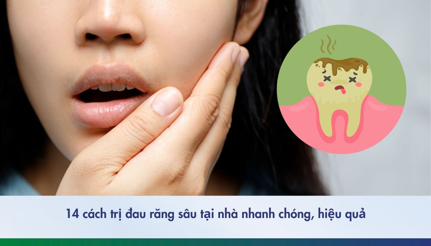 14 cách giảm đau răng sâu nhanh tại nhà