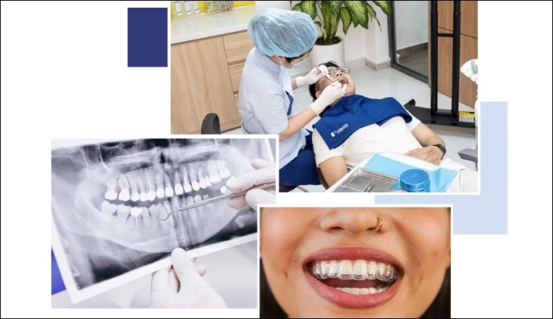 Bác sĩ Invisalign Red Diamond có khả năng phân tích và lập kế hoạch điều trị phù hợp nhất cho mỗi bệnh nhân