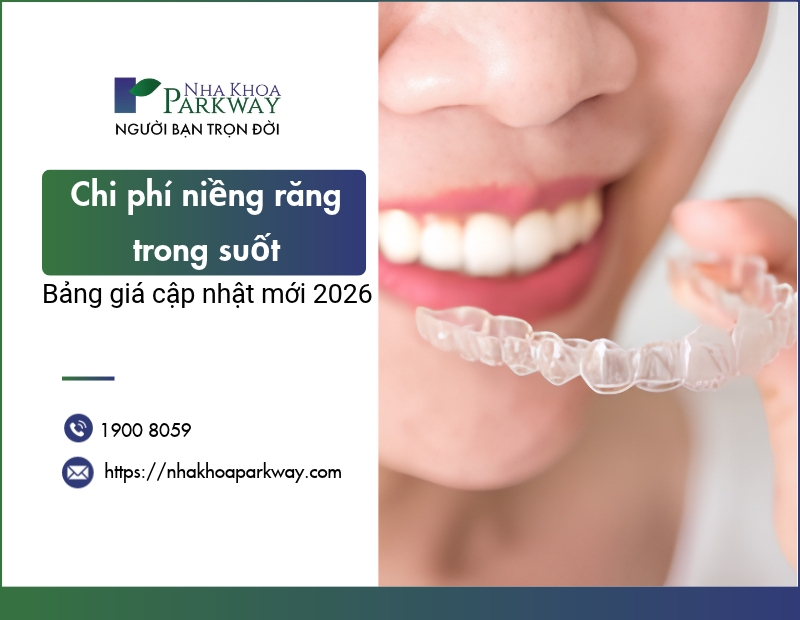 Chi phí niềng răng trong suốt: Bảng giá cập nhật mới 2026
