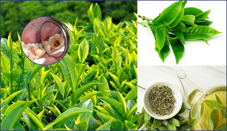 Chữa nhức răng có lỗ bằng trà xanh