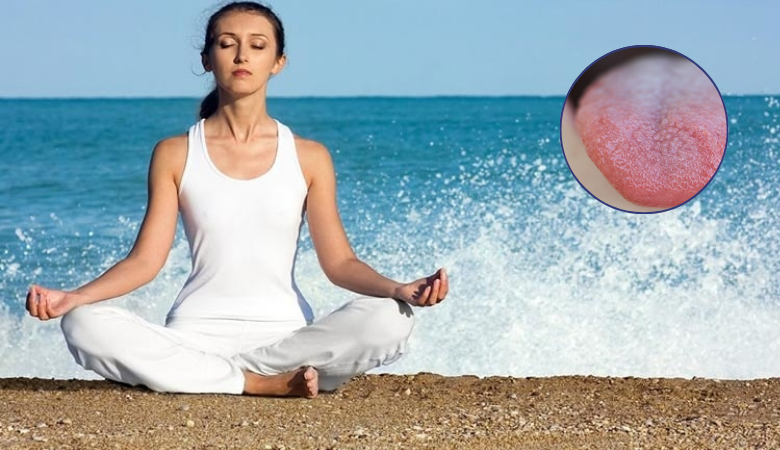 Giảm căng thẳng