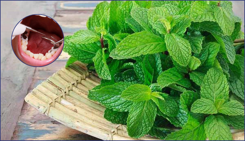 Trị nhức răng có lỗ bằng lá bạc hà