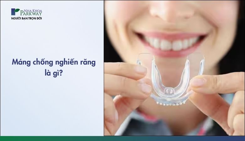 Tìm hiểu về máng chống nghiến răng