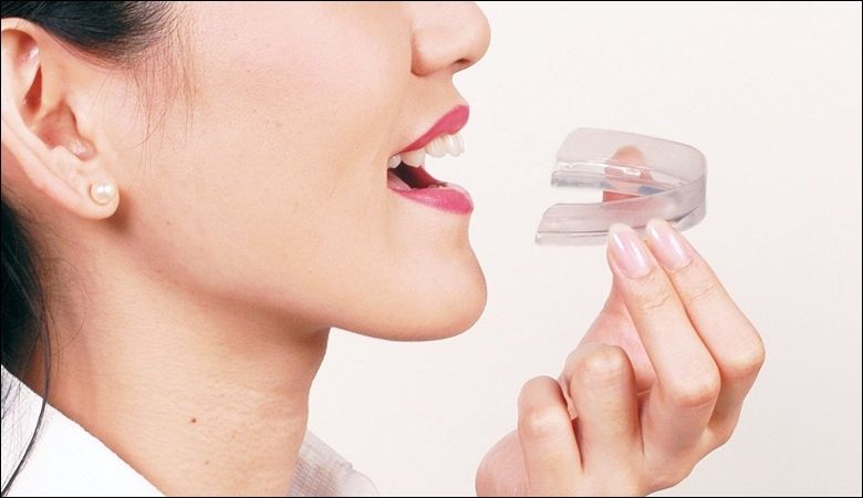 Máng chống nghiến răng nhựa mềm