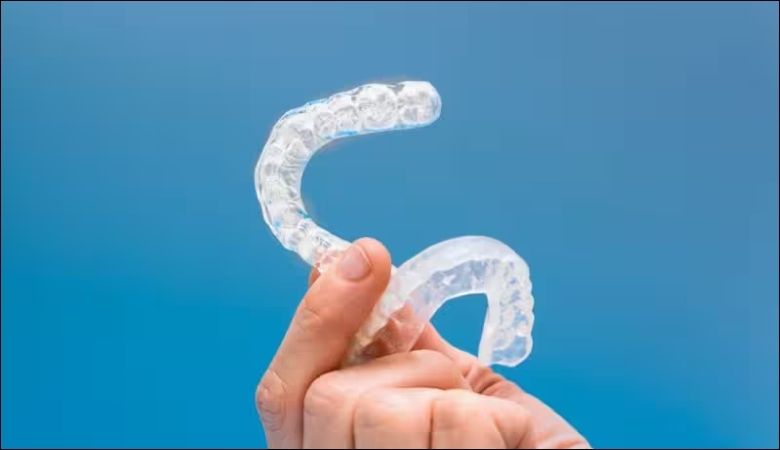 Máng chống nghiến răng làm từ nhựa dẻo