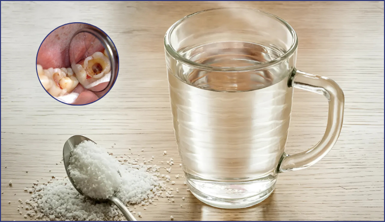 Súc miệng bằng nước muối