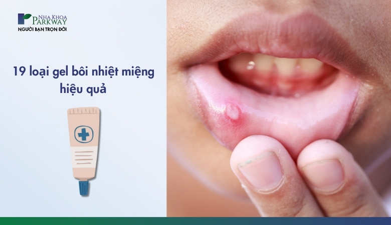 19 thuốc bôi nhiệt miệng tốt
